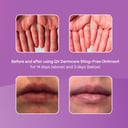 EGO QV DERMCARE STING FREE OINTMENT 100G thumbnail 7