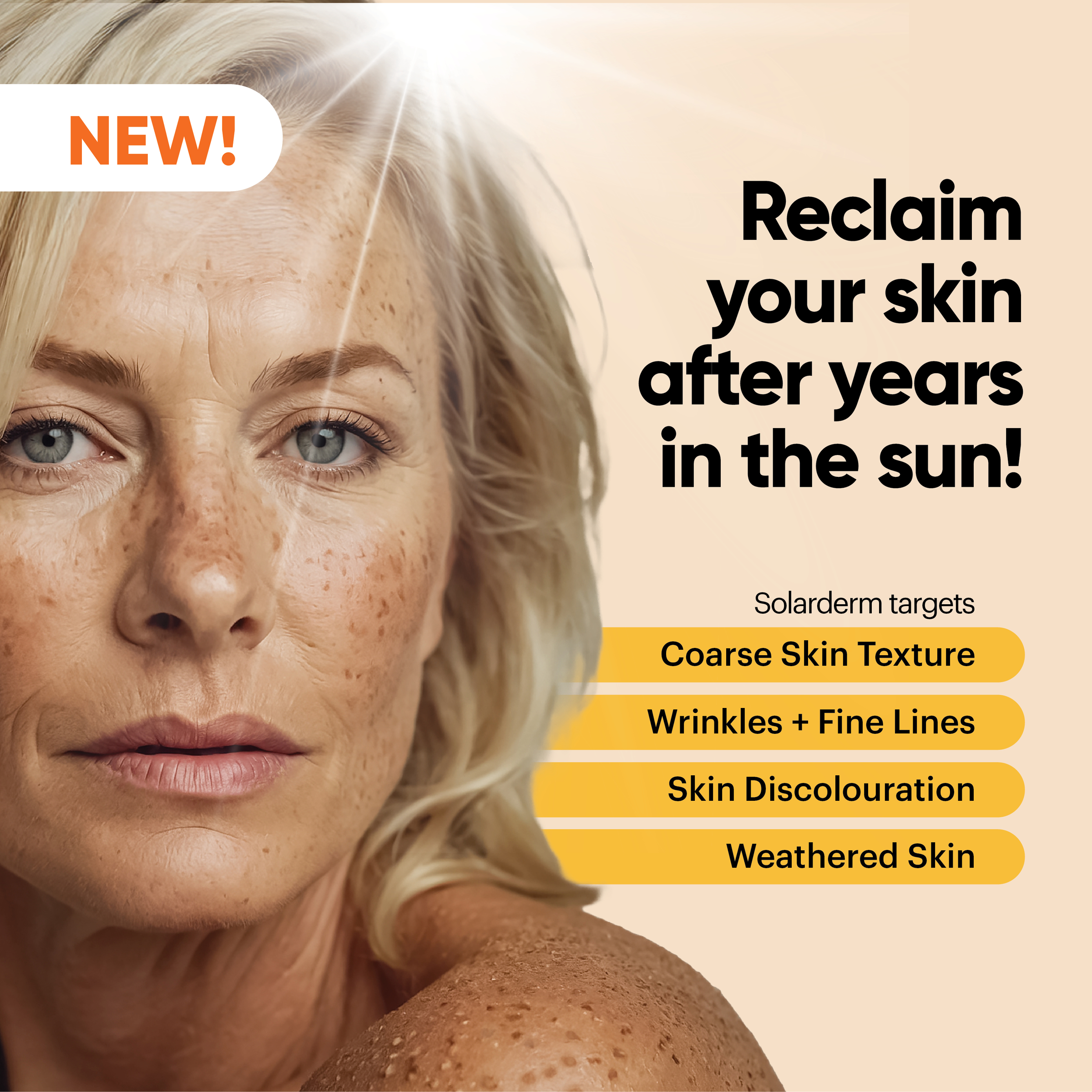 John Plunketts Solarderm Face & Body Recovery Cream 85ml - Image 3