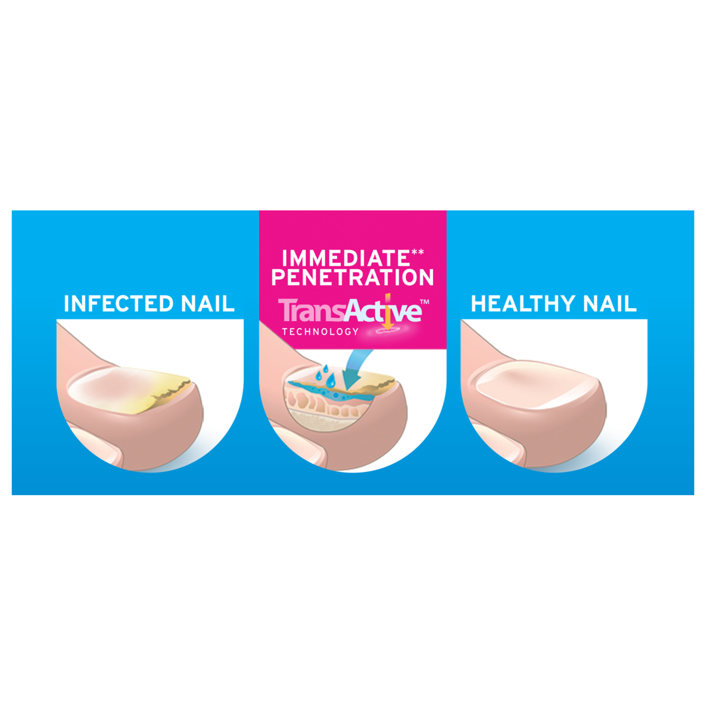 EXCILOR NAIL ANTI FUNGAL PEN - Image 5