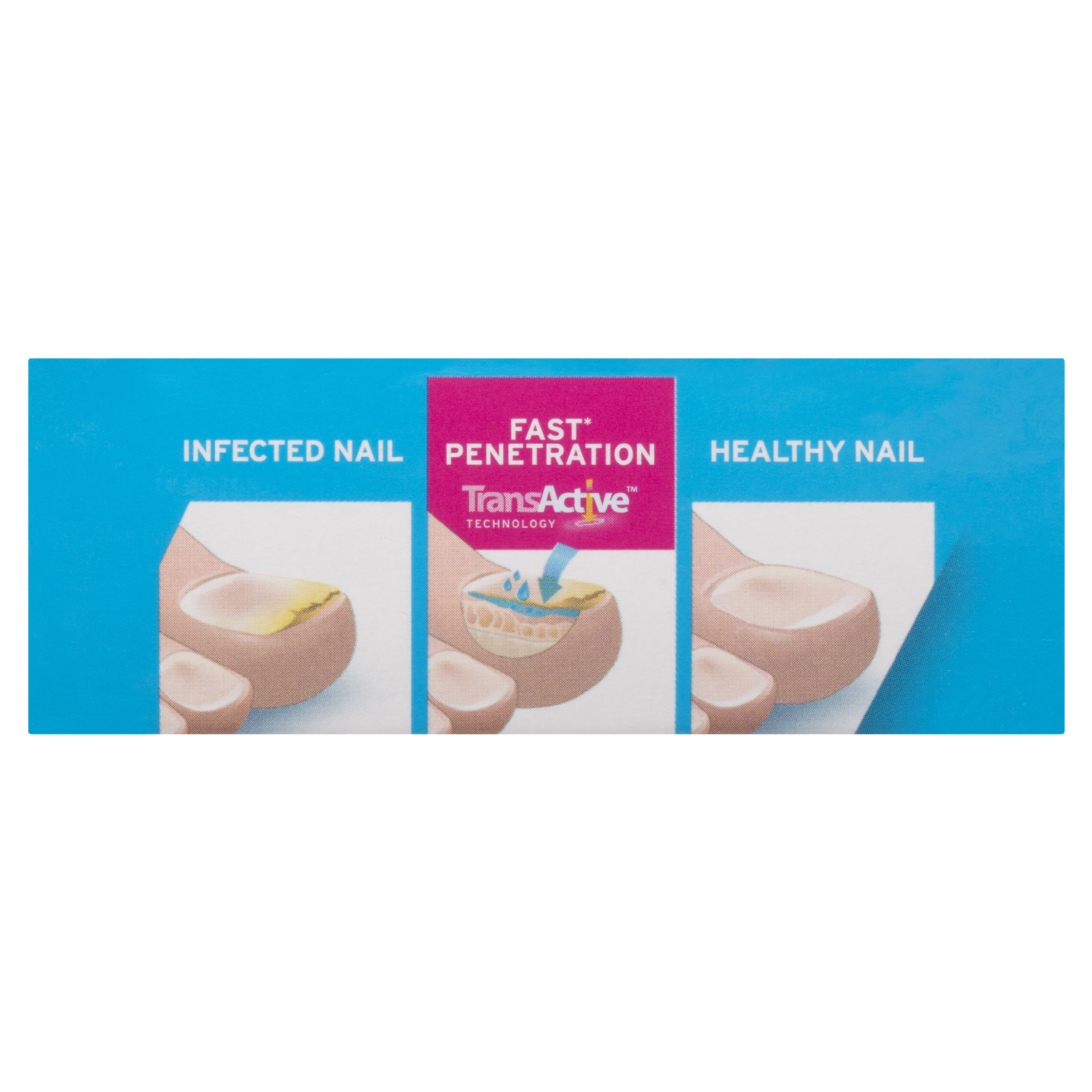 EYEZEP ALLERGY EYE DROPS 6ML - Image 5