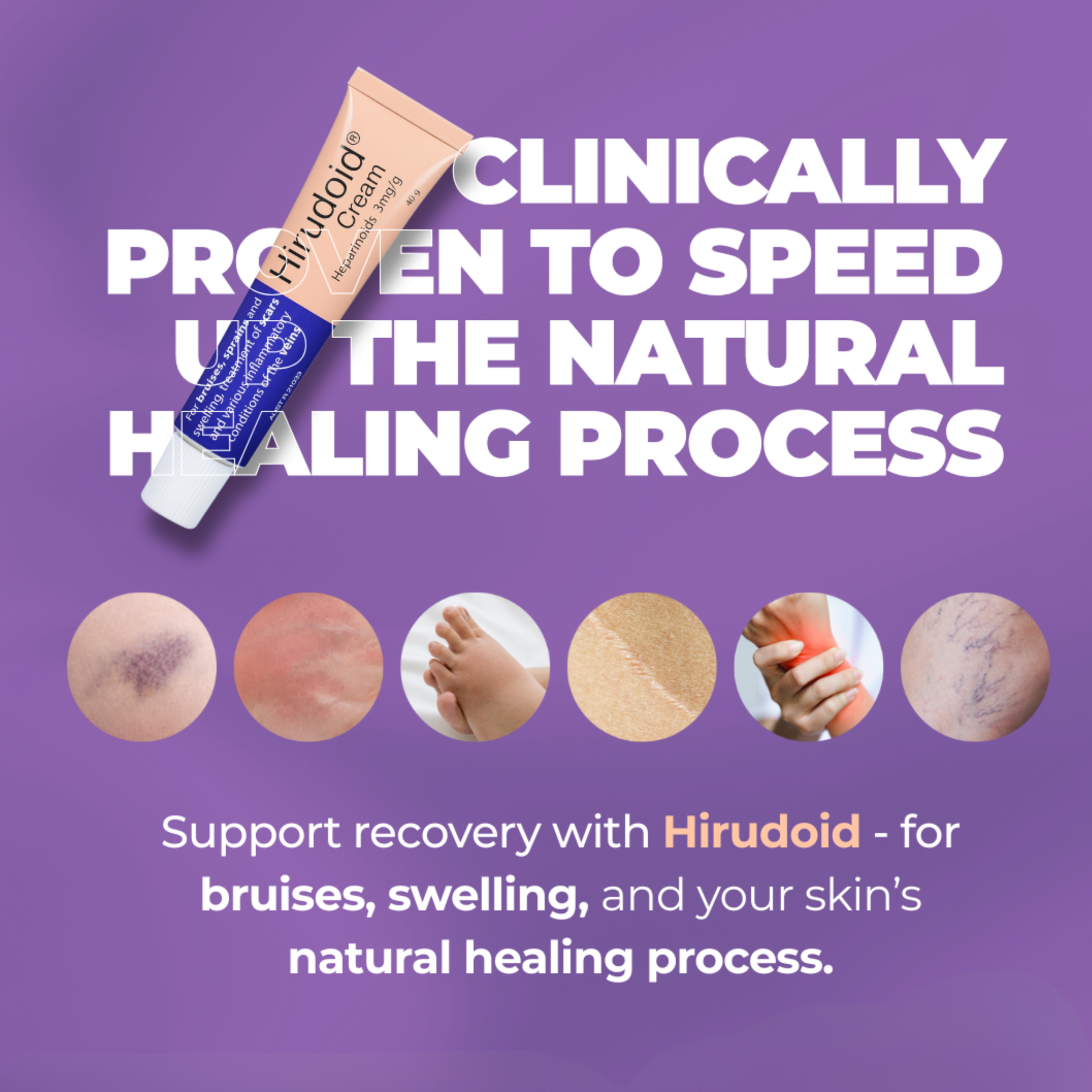 HIRUDOID CREAM 20G - Image 3